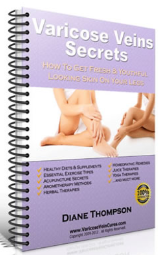 Varicose Veins Secrets By Diane Thompson - eBook PDF Program